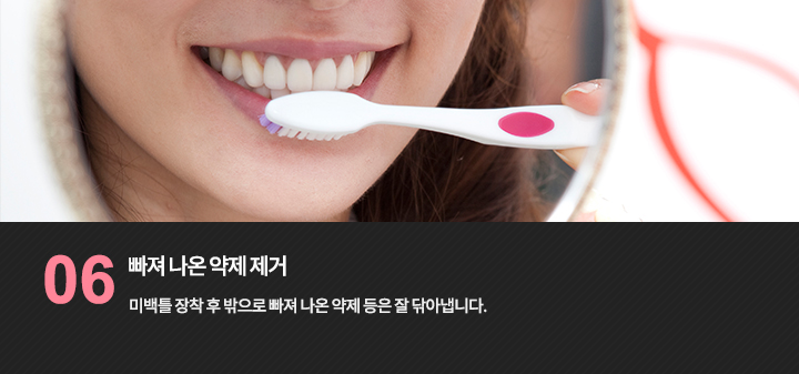 미백틀 장착 후 밖으로 빠져 나온 약제 등은 잘 닦아냅니다.